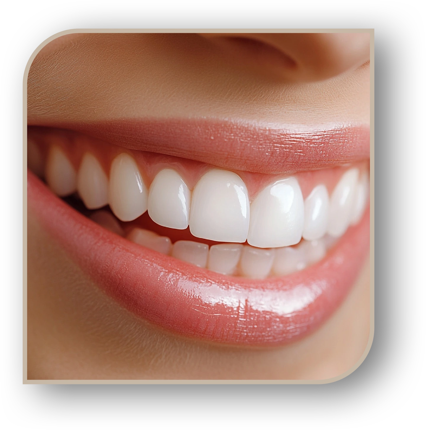 clareamento dental